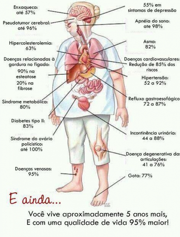 Consequências da Obesidade